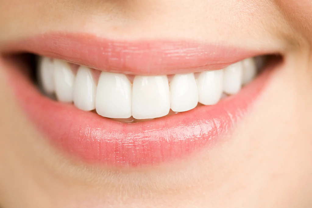 Clareamento Dental
